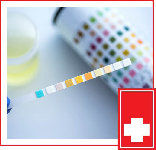 BLOOD & URINE SCREENING