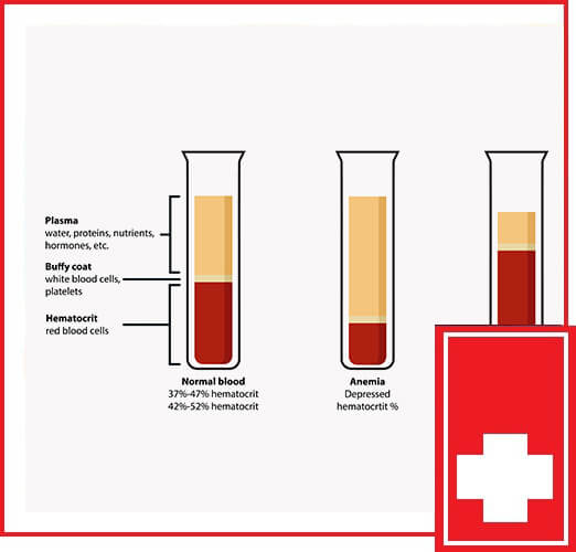 HOW ARE LAB TESTS ANALYZED?