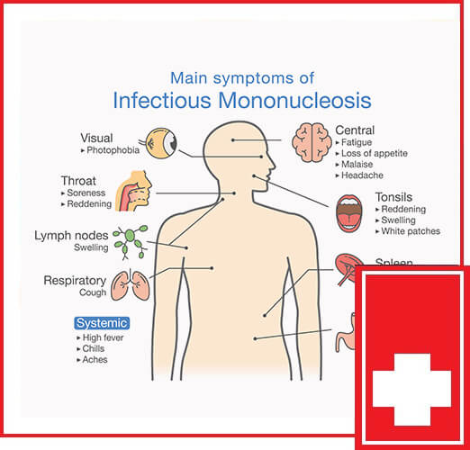 WHAT IS INFECTIOUS MONONUCLEOSIS (MONO)?