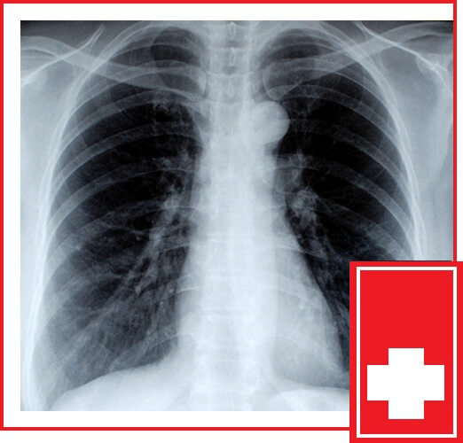 WHAT IS AN X-RAY?